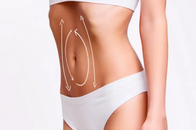 Lipoescultura de definição anatômica